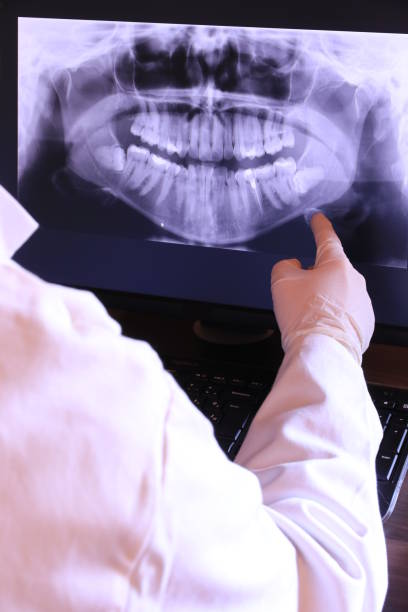 Best Emergency Dental Care for Broken or Chipped Teeth in Lithopolis, OH