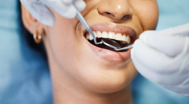 Best Emergency Wisdom Teeth Removal in Lithopolis, OH