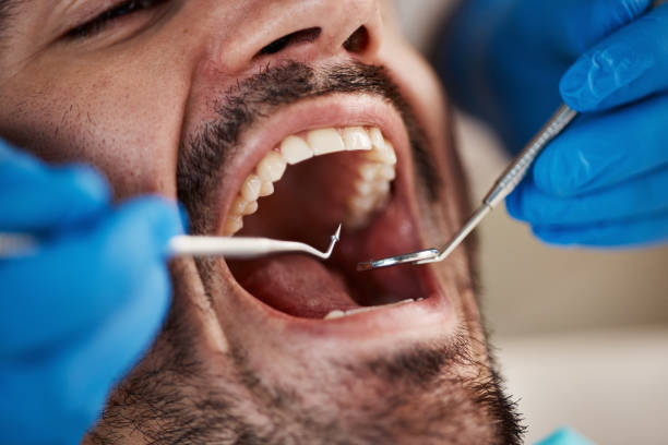Best Pediatric Emergency Dentist in Lithopolis, OH