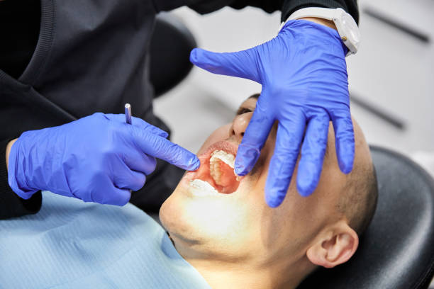 Best Emergency Dental Care for Broken or Chipped Teeth in Lithopolis, OH